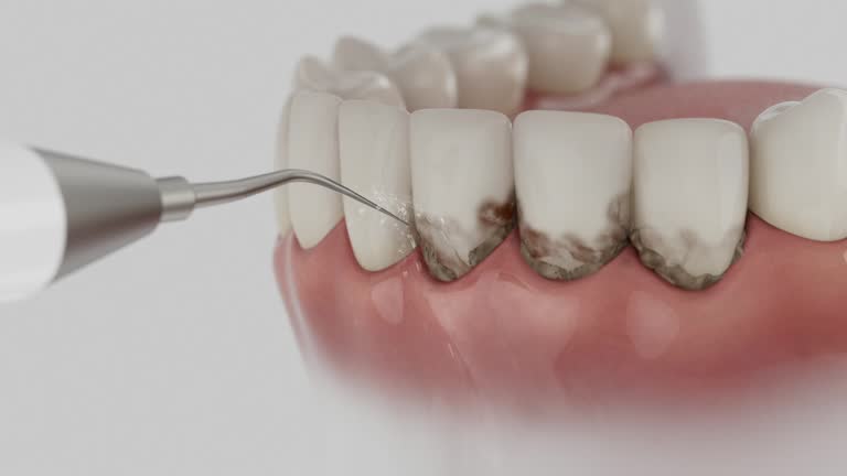 Trusted Wisdom Tooth Removal service in Enfield, NC - Dentist Open Now